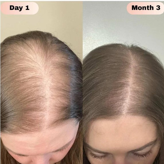 Bodywise Hair Growth Serum 10ml