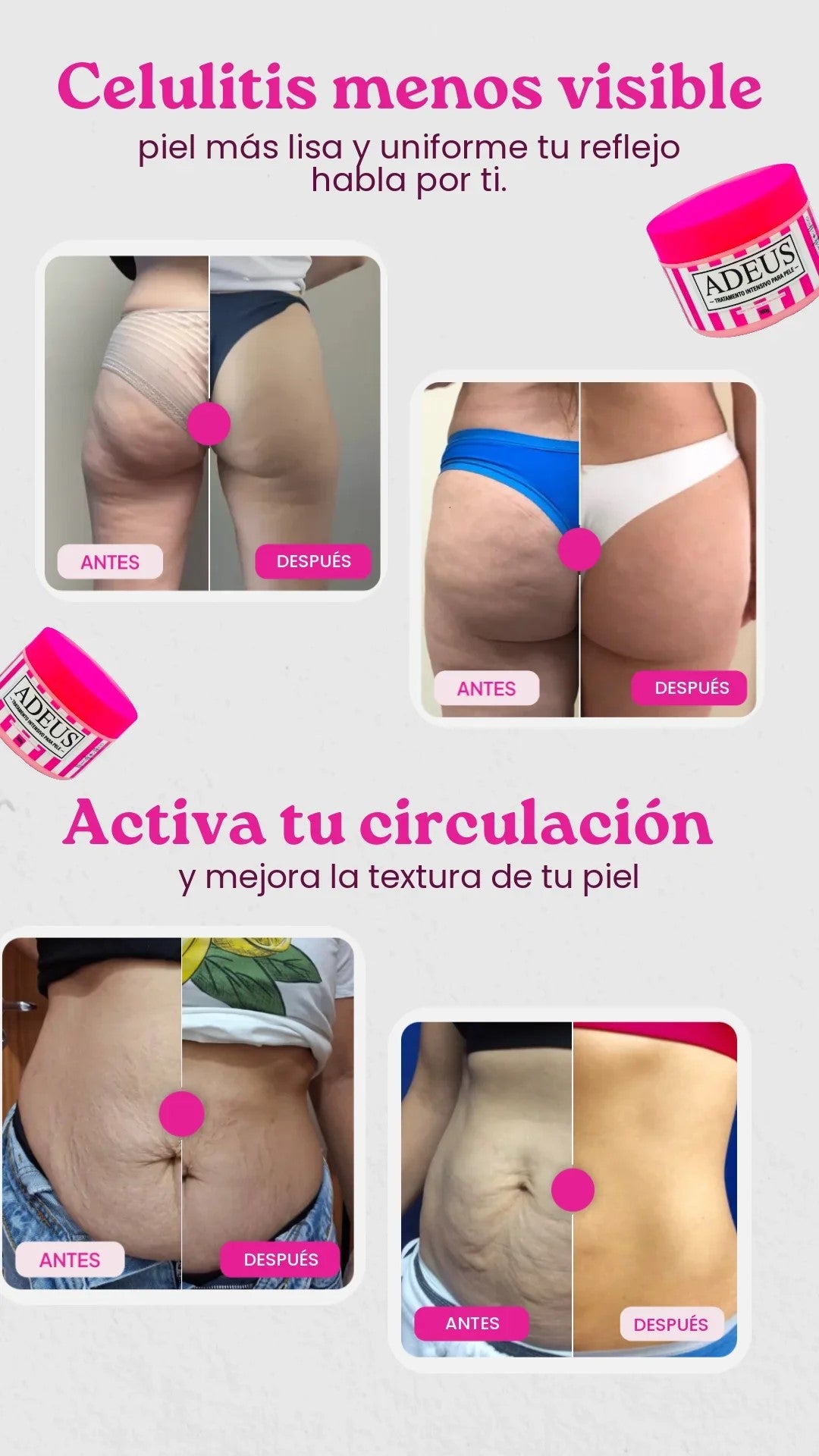 ADEUS – Crema para las Imperfecciones