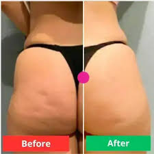 ADEUS – Crema para las Imperfecciones